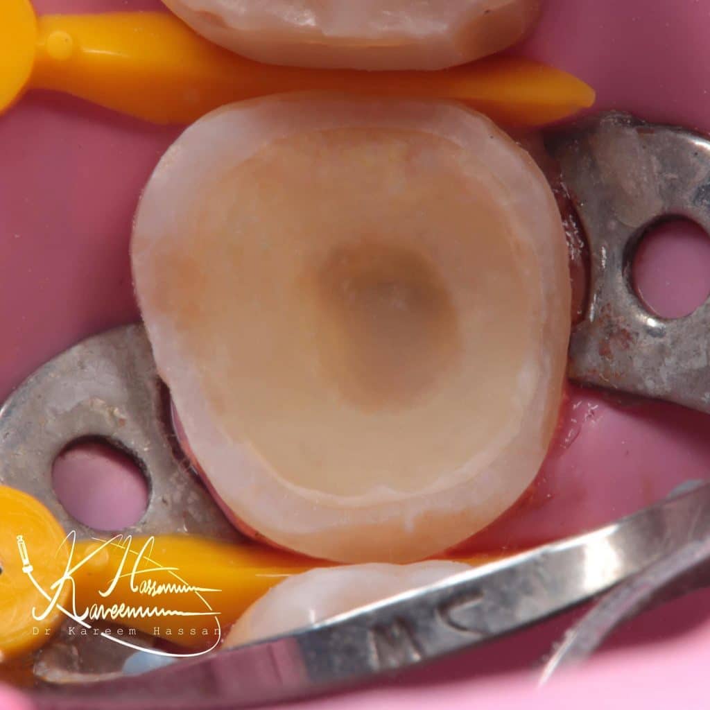 52019785-13A4-4BDA-A77D-B511AA1AA28B