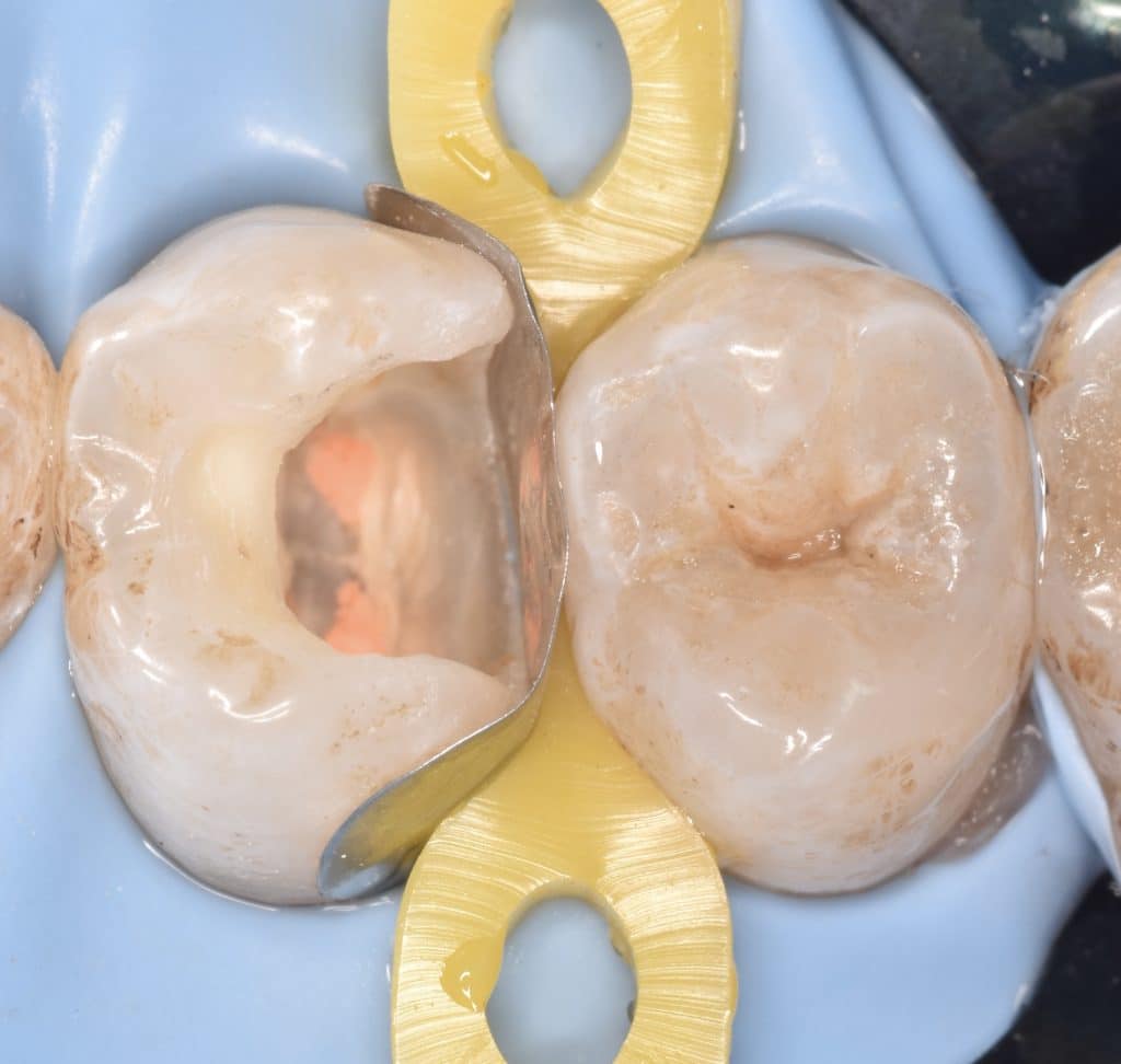 5BECD463-234F-4B87-A58D-0DD11A9033EA