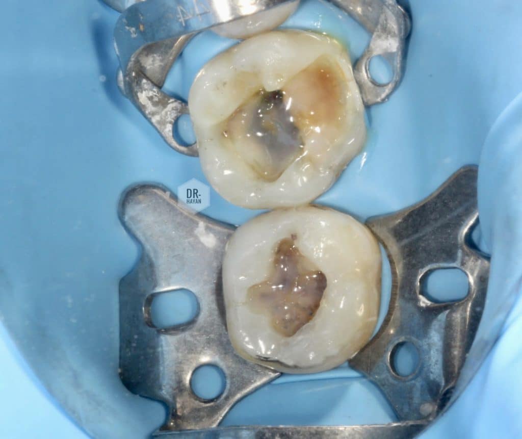 65229596-6249-4972-9ED8-E863C0A25885