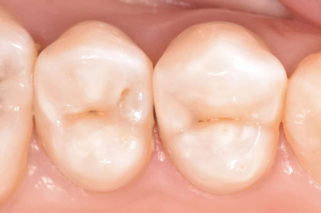 65B42963-D06B-46D2-AE6C-9BDAFD36EACA