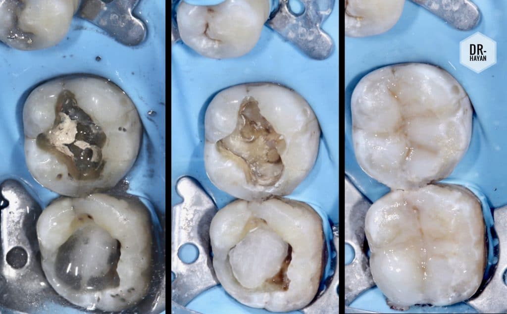 70D930C6-C236-4F0A-A905-B7AE50DBD7A3