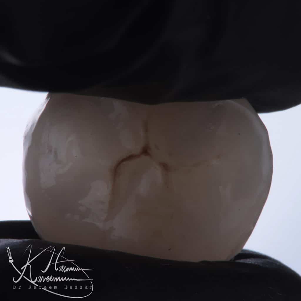 7C3E82F2-1A1F-4EA5-83E5-1CACF911D112