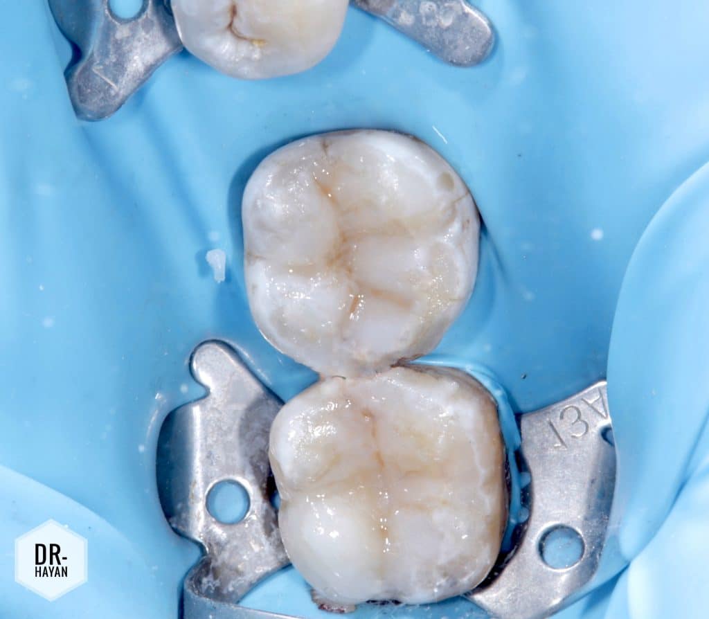 86E4B577-F397-4B9A-955D-6AF60A810B16