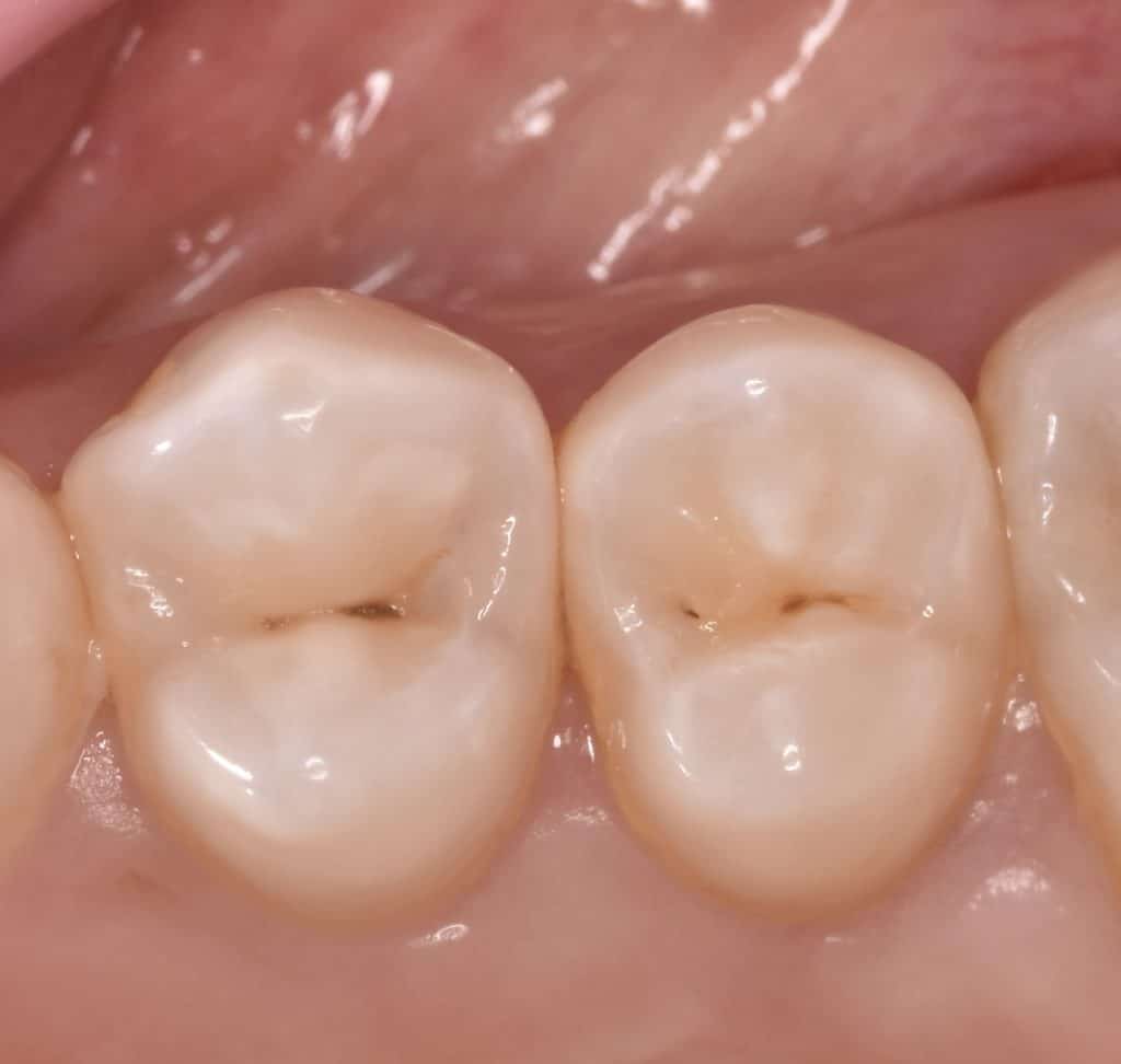 87EA27E4-28EE-4EEB-BB73-DD0649F43B32