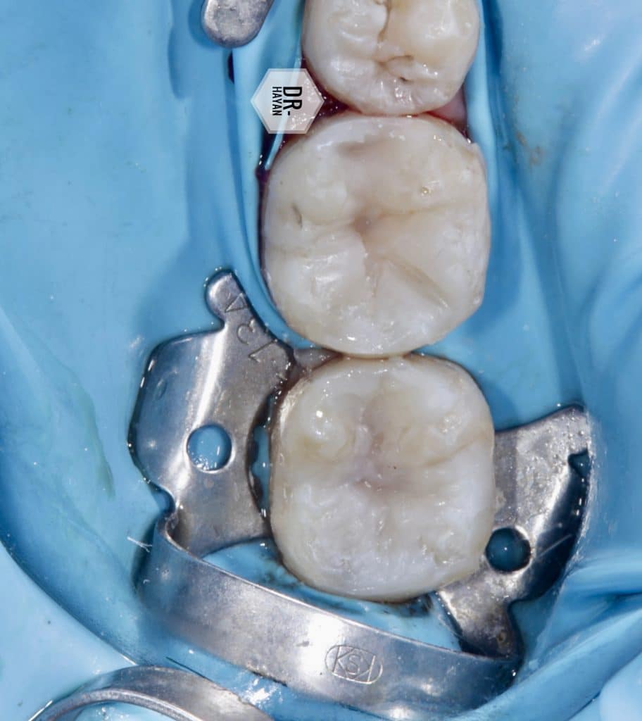 903012FF-B78A-49F7-9816-824F48480259