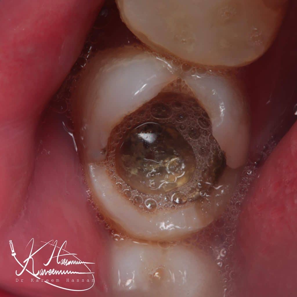 940420DA-0B67-4C0A-A48A-69F9E32719BC