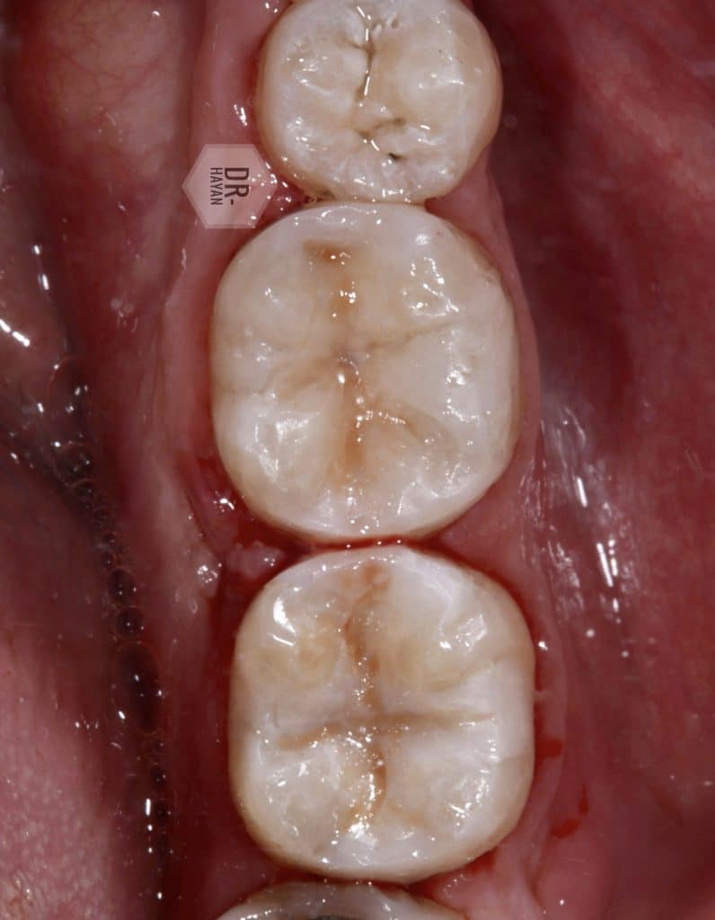 94E6C477-255B-4CCD-8D36-22300E46EE38