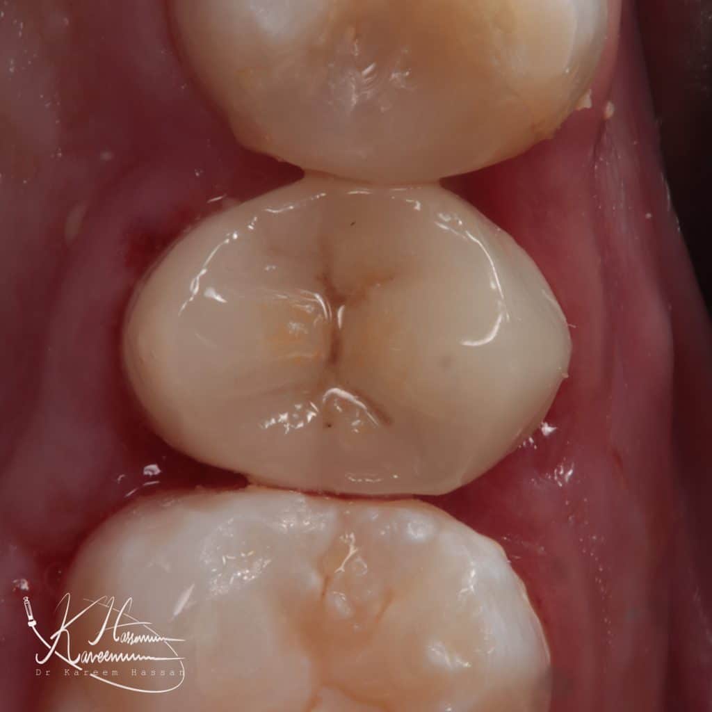 95B461D3-D925-4A7D-BAF1-582E05C7651F