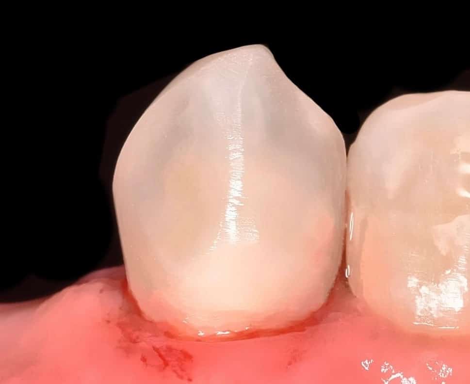 95E50A98-AD33-4A06-94FB-5CFB203F111A