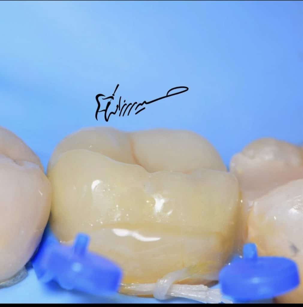 971B6B39-426B-4500-9E6A-3277D18C6ADC