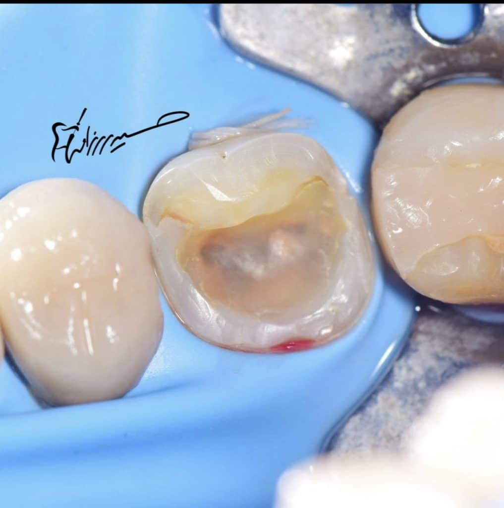 993980AF-41A4-462F-BAA5-061BFD662132