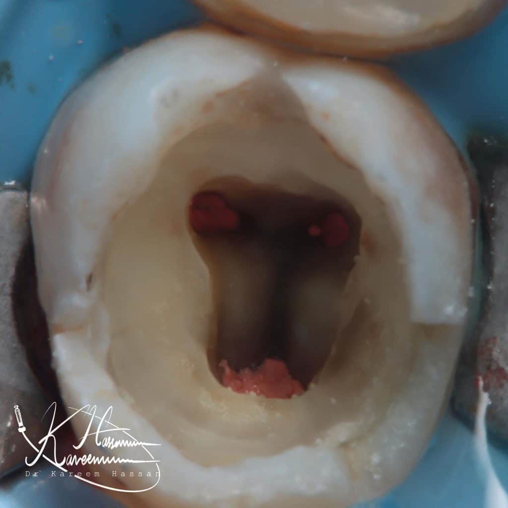 A0D52791-376F-4A7E-AA78-DF4EA712138D