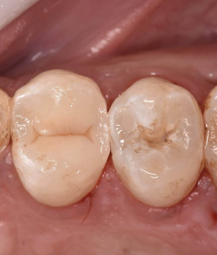 A63FB0BB-4861-498F-B9C9-7599C8820465