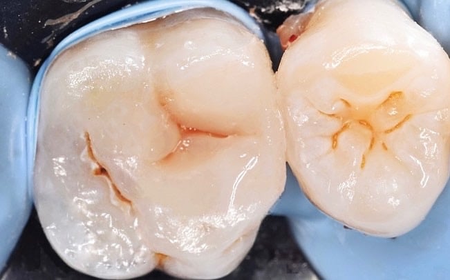 B7DFC381-B538-4B49-977D-70F6E29B808D