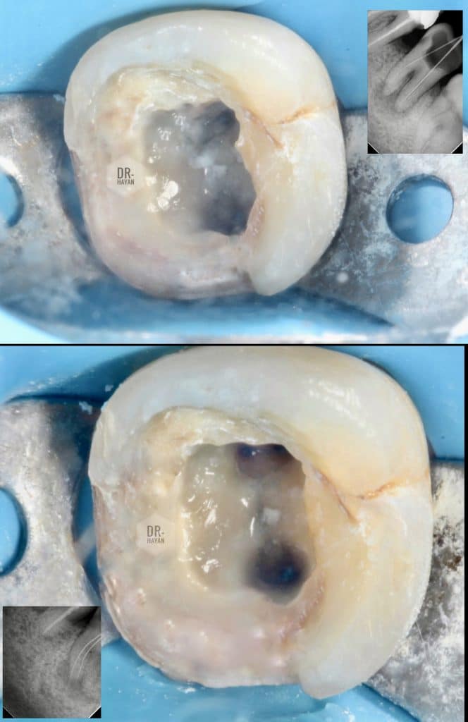 BECAEB00-E410-4668-8938-ADEBDC8C93A1