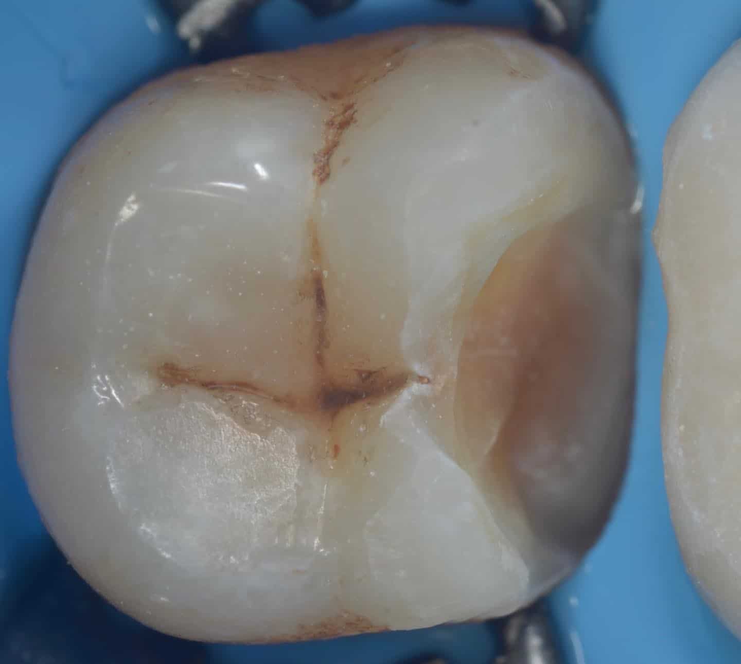 Biomimetic dentist near me