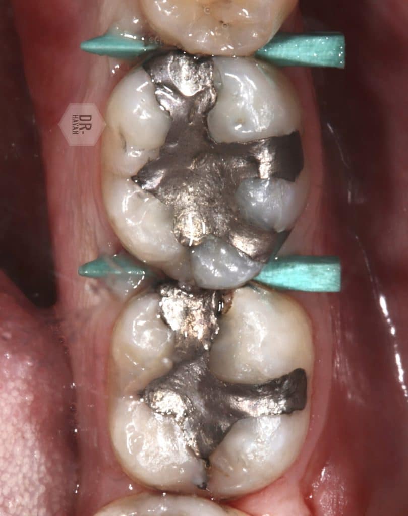 C22DF076-FE64-432D-A6DE-0DF55F51BEB4