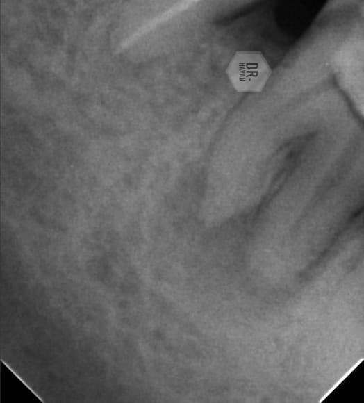 CA252691-B23E-4A19-9B9E-6EE0EB07358A