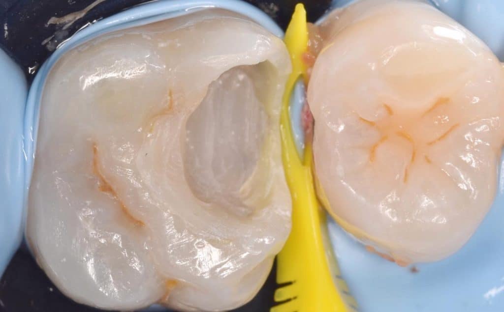 CC23A394-E101-4ED7-B163-944E5B20B73C