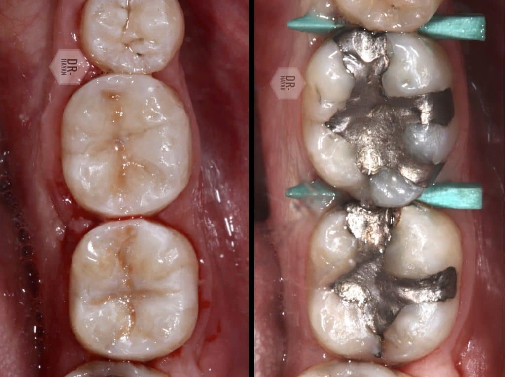 D1117CB7-F74F-4045-B72B-24E1D46D5518