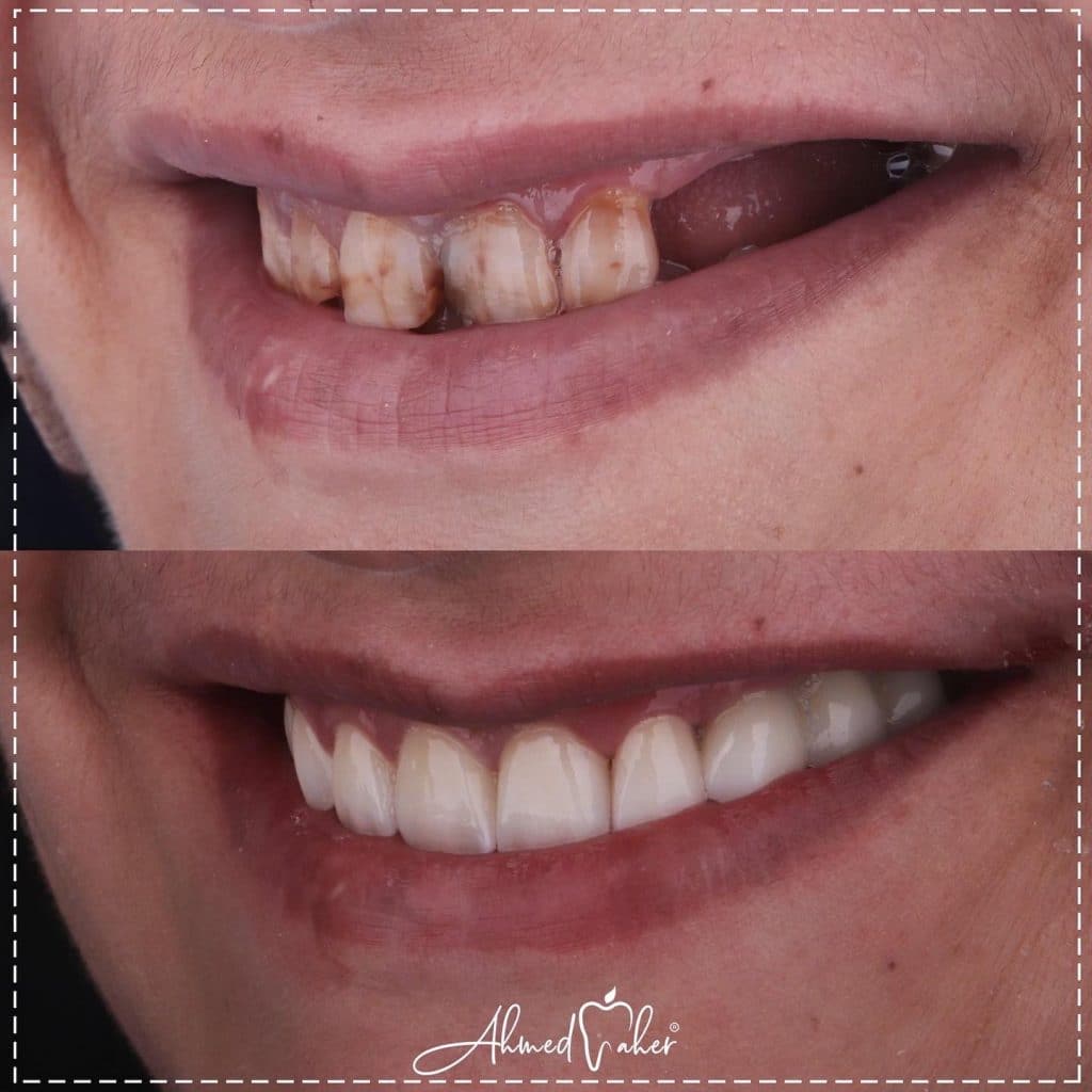 D83A0AD0-9CF0-40AE-9BD2-76FE6E7B34E1