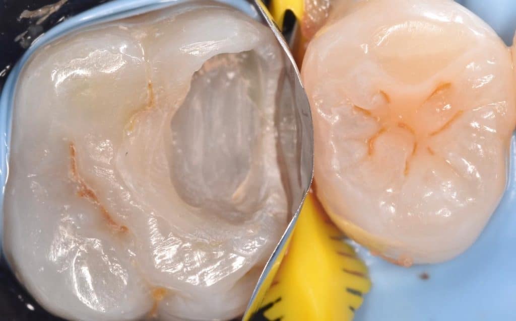 D8DBBCBF-2F49-4781-AA71-C80305EE9961