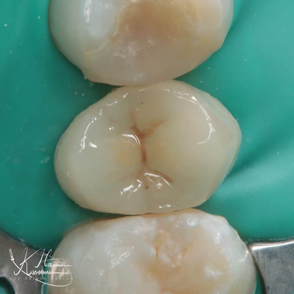 DBB23020-169F-481C-84F2-2E11025F4071