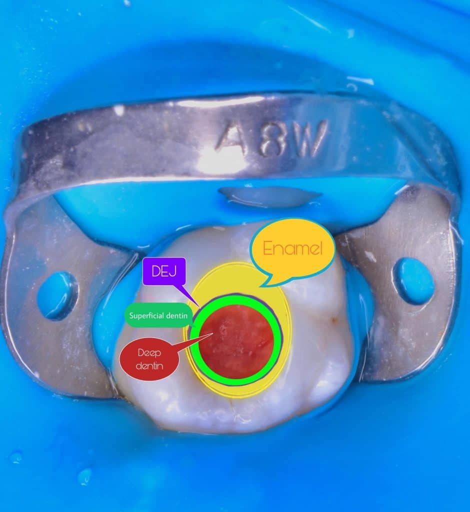 DF284921-A079-471A-9235-4C7E18BA3364