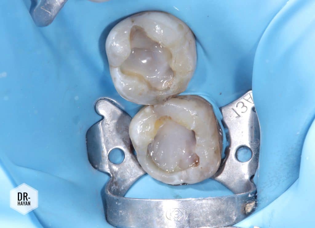 E2DED2F2-15B8-4B21-9C42-9A719216BC00