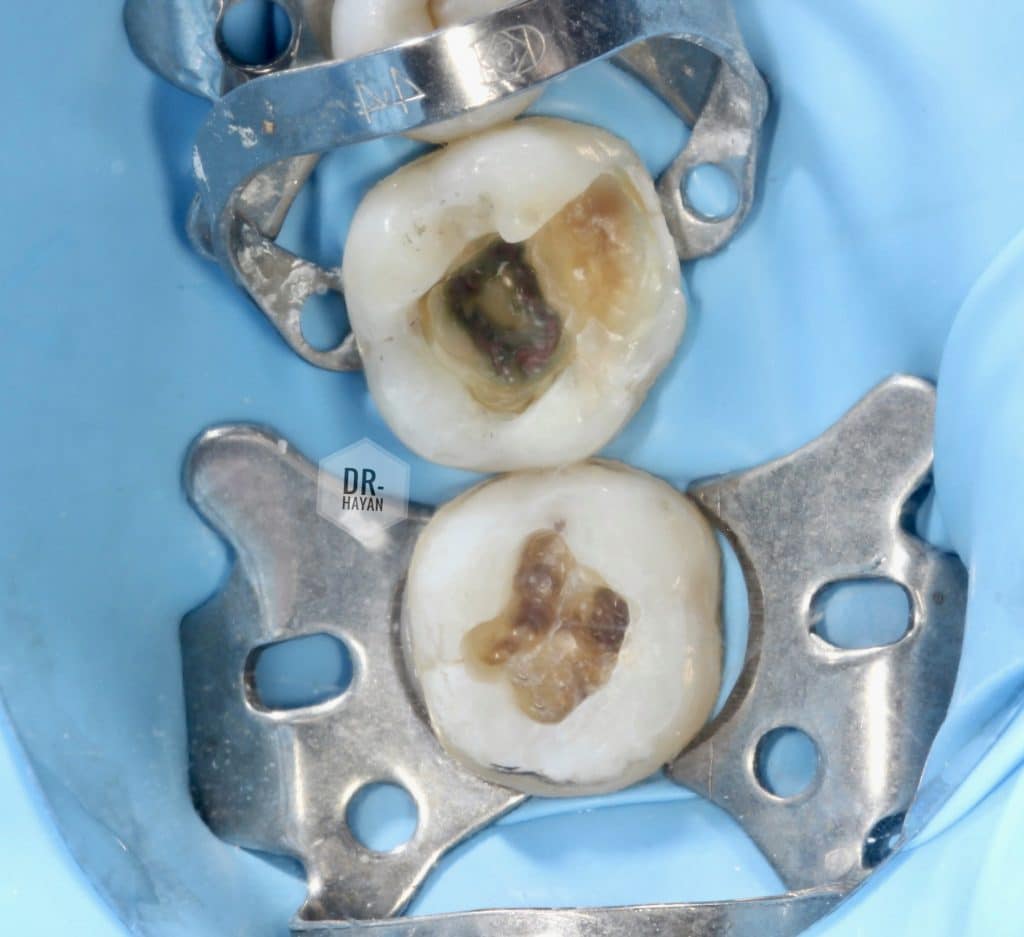 E3D5E18A-FE68-4DC7-9D6E-4D20DD27924B