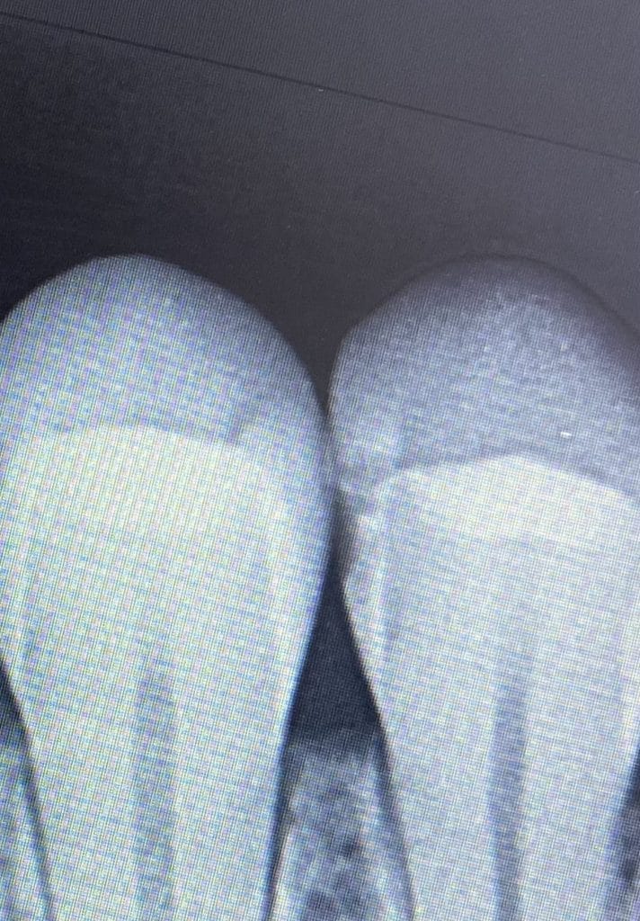 E7723A39-0D67-4C6C-9289-CCCF0FD7A505