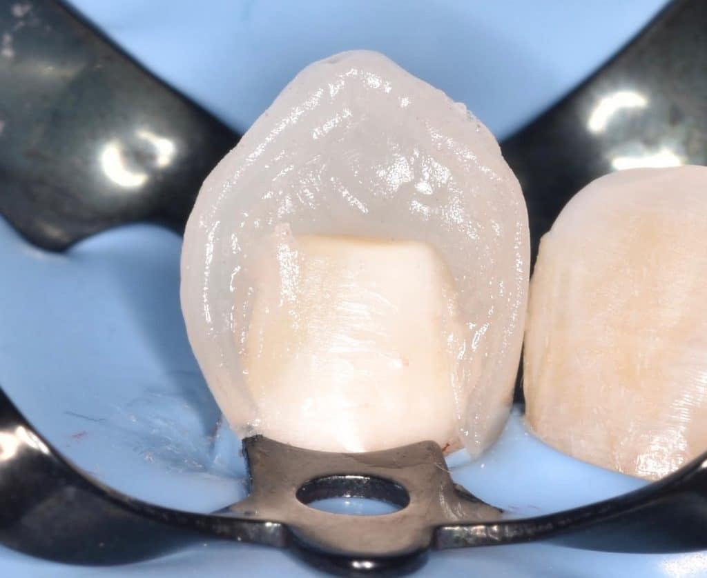 F204EB7B-E83C-41C1-95DF-DC8FD8F292F9