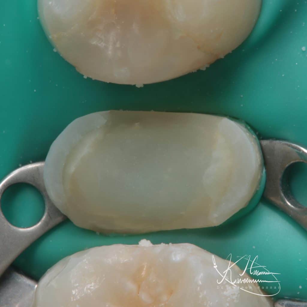 F315EA12-3406-4BDC-B821-C9D1057E11F9