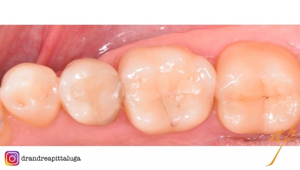 F59CB243-8B13-4931-8B78-607895A61E1A