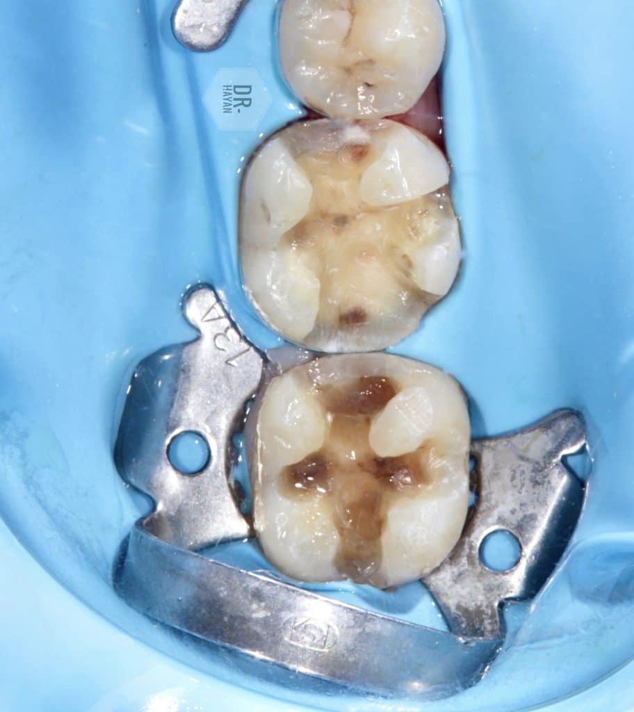 F64013D4-F58F-48EE-BFF6-341F8F93A6AC