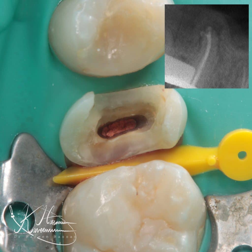 F68519FC-1C68-402E-A0C4-33EE0FCC1698