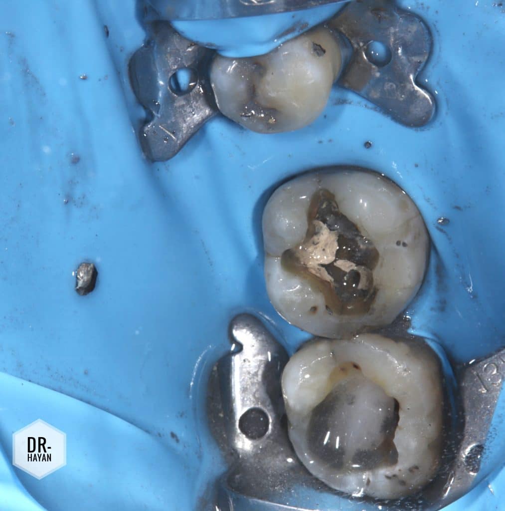 F7345714-633D-489B-BD75-20D0FE5CC0E0