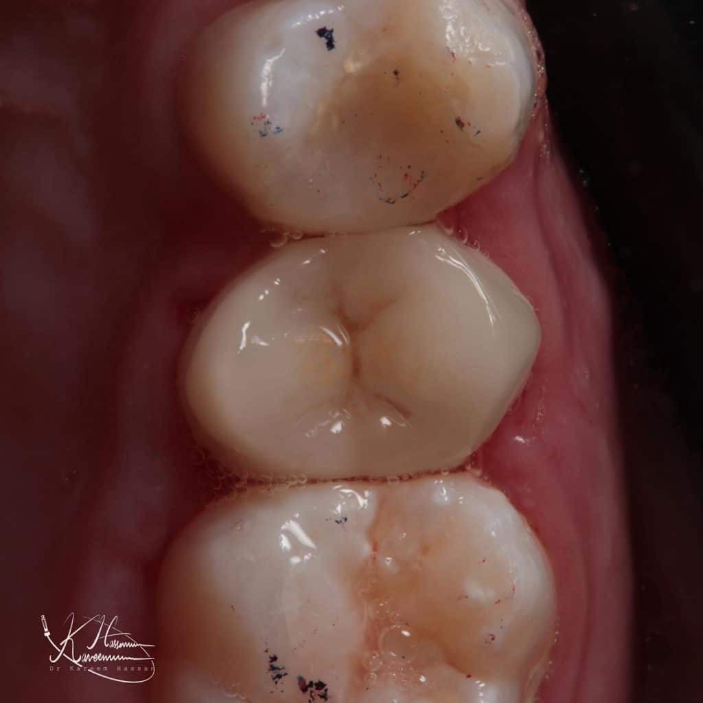 FFE0D175-280C-4796-9B3D-D01C1D181418