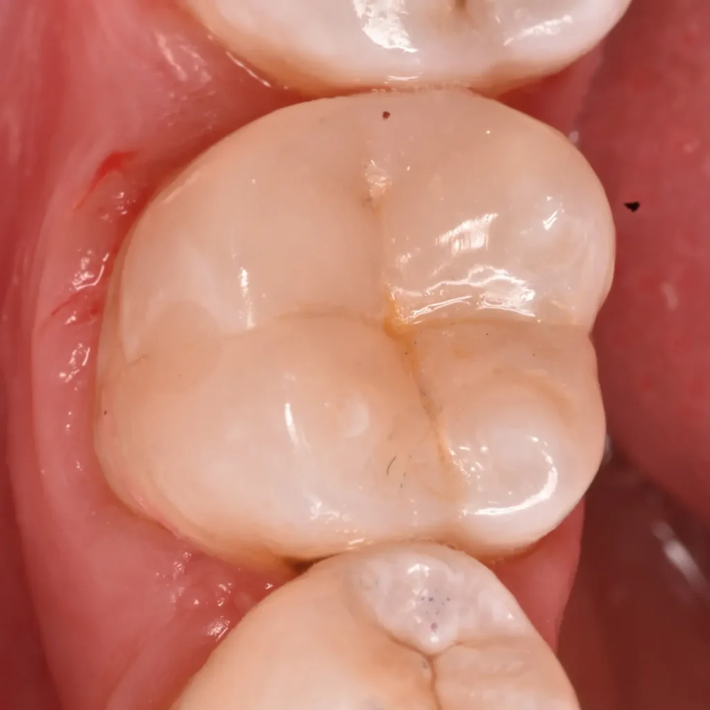 IMG_20220512_194433_741