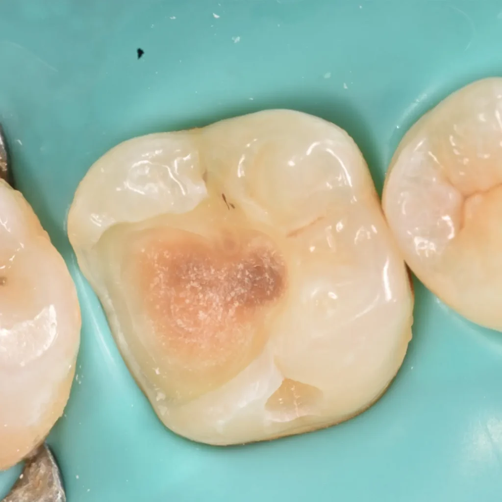 IMG_20220512_194433_776