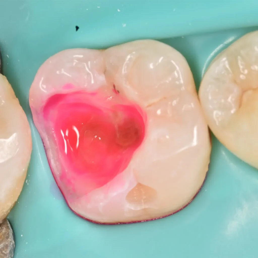 IMG_20220512_194433_838