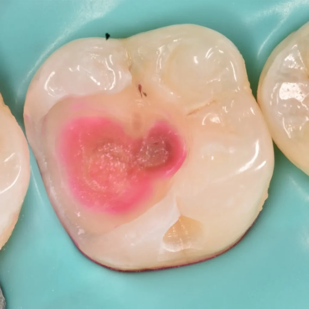 IMG_20220512_194433_880