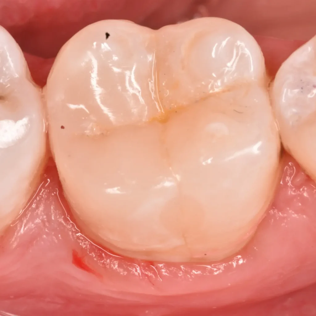 IMG_20220512_194434_018