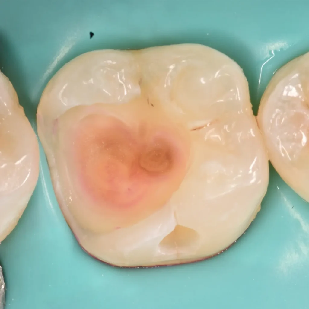 IMG_20220512_194949_797