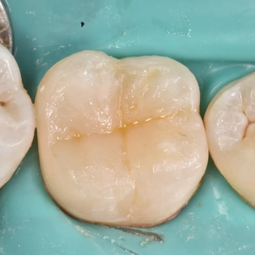 IMG_20220512_194949_827