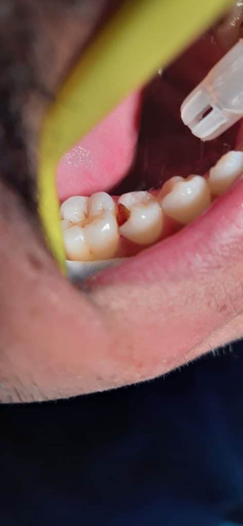 IMG_20220526_155235_894