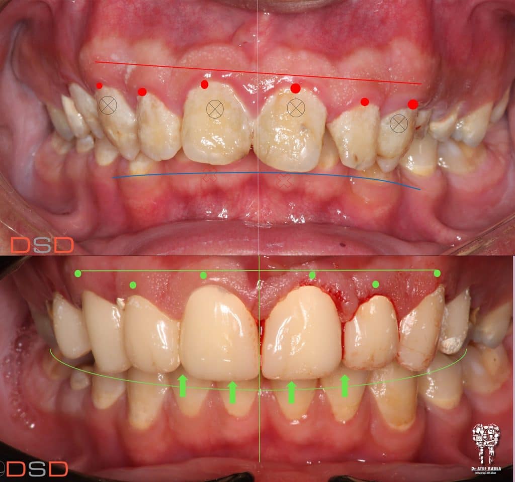 inbound1167395471391985003