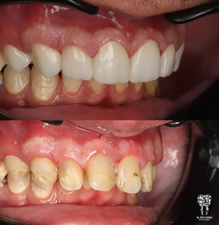 inbound5632475589289927192