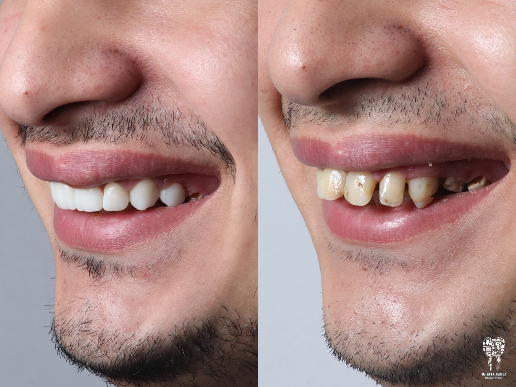 inbound8297632411677877241