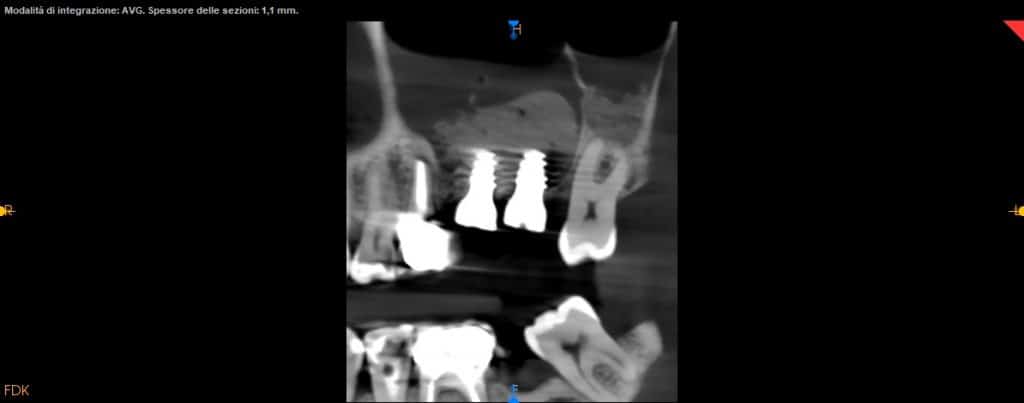 panoramix x ray view